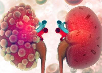 نانوذرات شیرین کلیه را گول می زنند