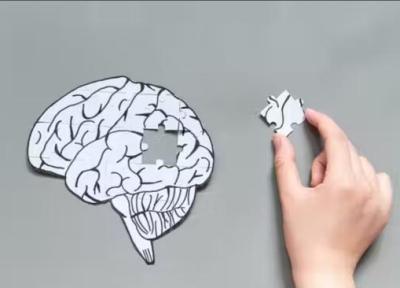 این آزمایش، جایگزین روش رایج تصویربرداری از مغز و آزمایش مایع نخاعی است